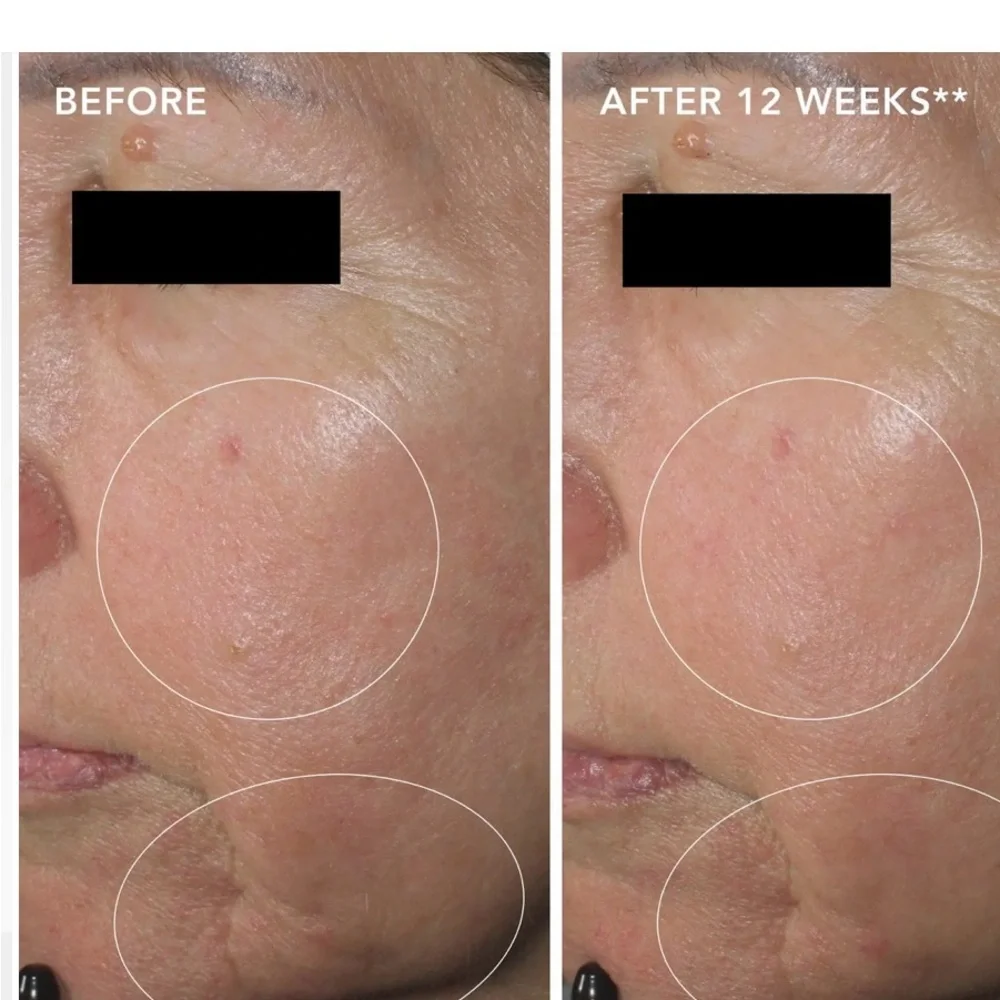 Image Skincare Restoring Power-C Serum 1oz.